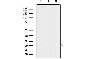 anti-Centrin, EF-Hand Protein, 1 (CETN1) (Internal Region) antibody