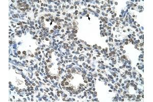 NKD1 antibody was used for immunohistochemistry at a concentration of 4-8 ug/ml to stain Alveolar cells (arrows) in Human Lung. (NKD1 antibody)