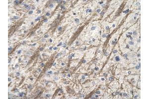 Rabbit Anti-ZNF74 antibody        Paraffin Embedded Tissue:  Human Brain cell   Cellular Data:  Epithelial cells of renal tubule  Antibody Concentration:   4. (ZNF74 antibody  (Middle Region))