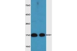 Mouse brain lysates probed with Rabbit Anti-SOD1 Polyclonal Antibody, Unconjugated  at 1:3000 for 90 min at 37˚C. (SOD1 antibody  (AA 6-100))