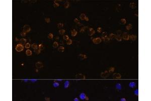 Immunofluorescence analysis of Jurkat cells using KLRC4 Polyclonal Antibody at dilution of 1:100 (40x lens). (KLRC4 antibody)