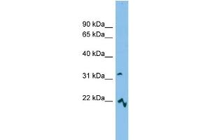 WB Suggested Anti-MCART6 Antibody Titration: 0. (MCART6 antibody  (Middle Region))