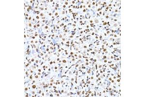 Immunohistochemistry of paraffin-embedded rat ovary using RBM3 Rabbit mAb (ABIN7270084) at dilution of 1:25 (40x lens). (RBM3 antibody)