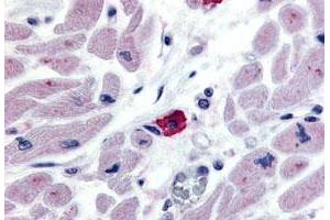 Immunohistochemistry (Formalin/PFA-fixed paraffin-embedded sections) of human macrophages tissue with EMR3 polyclonal antibody . (EMR3 antibody  (N-Term))