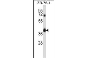 DGT1 Antibody (N-term) (ABIN657891 and ABIN2846843) western blot analysis in ZR-75-1 cell line lysates (35 μg/lane). (DPAGT1 antibody  (N-Term))