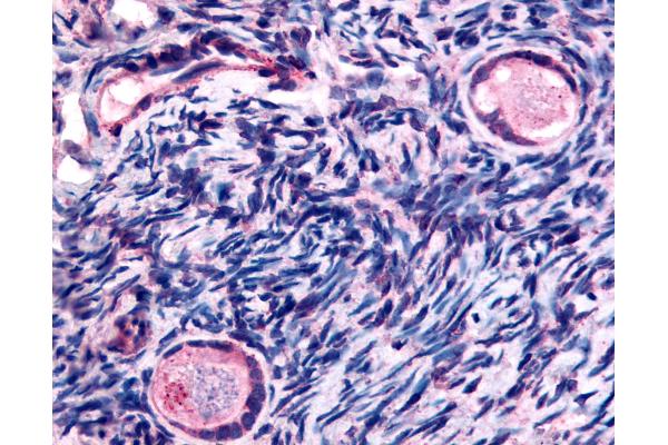 TMEM5 antibody  (Extracellular Domain)
