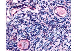 Anti-TMEM5 antibody IHC of human ovary, oocytes.
