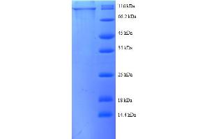 SDS-PAGE (SDS) image for Catenin (Cadherin-Associated Protein), beta 1, 88kDa (CTNNB1) (AA 2-781), (partial) protein (GST tag) (ABIN5712039)