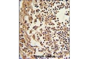 Formalin-fixed and paraffin-embedded human lymph reacted with EEF1D Antibody (N-term), which was peroxidase-conjugated to the secondary antibody, followed by DAB staining. (EEF1D antibody  (N-Term))