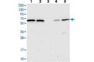 Western blot analysis of Lane 1: RT-4, Lane 2: U-251 MG, Lane 3: Human Plasma, Lane 4: Liver, Lane 5: Tonsil with POLR3E polyclonal antibody  at 1:250-1:500 dilution.