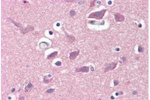 Human Brain, Cortex (formalin-fixed, paraffin-embedded) stained with GRIA2 antibody ABIN351533 at 1:50 followed by biotinylated anti-mouse IgG secondary antibody ABIN481714, alkaline phosphatase-streptavidin and chromogen. (GRIA2 antibody  (AA 175-430))