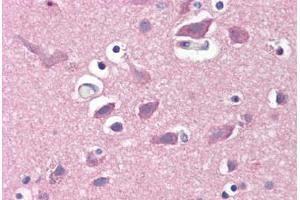 Human Brain, Cortex (formalin-fixed, paraffin-embedded) stained with GRIA2 antibody ABIN351533 at 1:50 followed by biotinylated anti-mouse IgG secondary antibody ABIN481714, alkaline phosphatase-streptavidin and chromogen.