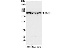 anti-BCL6 Co-Repressor (BCOR) (AA 1705-1755) antibody