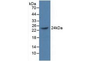 Detection of Recombinant PCGF4, Human using Polyclonal Antibody to Polycomb Group Ring Finger Protein 4 (PCGF4) (BMI1 antibody  (AA 152-289))