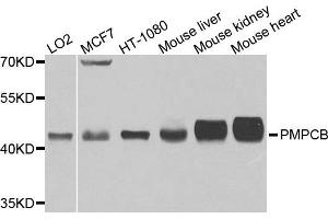 Western blot analysis of extracts of various cells, using PMPCB antibody. (PMPCB antibody)