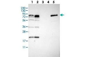 Western blot analysis of Lane 1: RT-4, Lane 2: U-251 MG, Lane 3: Human Plasma, Lane 4: Liver, Lane 5: Tonsil with PNPLA8 polyclonal antibody  at 1:250-1:500 dilution. (PNPLA8 antibody)