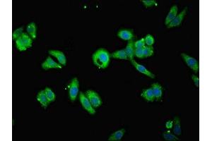 Immunofluorescent analysis of HepG2 cells using ABIN7159887 at dilution of 1:100 and Alexa Fluor 488-congugated AffiniPure Goat Anti-Rabbit IgG(H+L) (TIMM1B (AA 1-103) antibody)