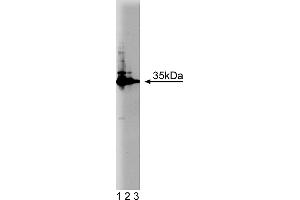 Western Blotting (WB) image for anti-HCLS1 Associated Protein X-1 (HAX1) (AA 10-148) antibody (ABIN968199) (HAX1 antibody  (AA 10-148))