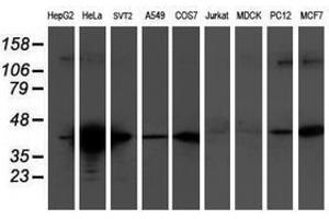Image no. 2 for anti-Tropomodulin 1 (TMOD1) antibody (ABIN1501528) (Tropomodulin 1 antibody)
