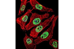 Fluorescent confocal image of A549 cell stained with FOXA2 Antibody (Center) (ABIN655072 and ABIN2844704). (FOXA2 antibody  (AA 128-157))