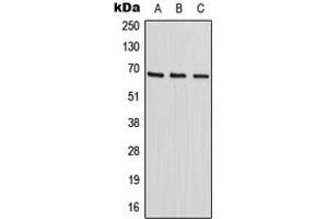 Western blot analysis of HIC2 expression in HepG2 (A), HeLa (B), NIH3T3 (C) whole cell lysates.