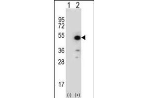 Western blot analysis of ID (arrow) using rabbit polyclonal ID Antibody (N-term) (ABIN652735 and ABIN2842487).