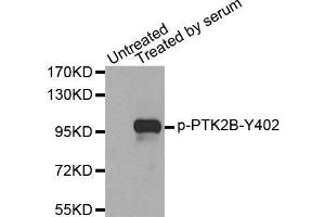 Western blot analysis of extracts from 293 cells, using Phospho-PTK2B-Y402 antibody. (PTK2B antibody  (pTyr402))