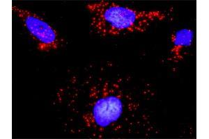 Proximity Ligation Analysis of protein-protein interactions between CDC42 and ARHGEF6. (ARHGEF6 antibody  (AA 61-175))
