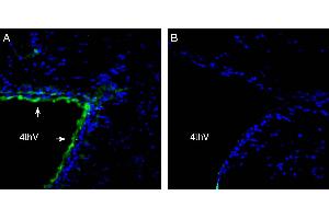 Expression of Parkin in rat  brain 4th ventricle.