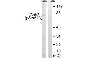 Immunohistochemistry analysis of paraffin-embedded human breast carcinoma tissue using Gab2 (Phospho-Ser623) antibody.