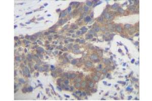 Image no. 2 for anti-Placenta Growth Factor (PGF) antibody (ABIN181639) (PLGF antibody)