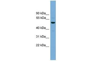 ASZ1 antibody used at 1 ug/ml to detect target protein. (ASZ1 antibody  (Middle Region))