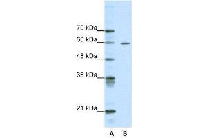 WB Suggested Anti-ARID3A  Antibody Titration: 0. (ARID3A antibody  (Middle Region))