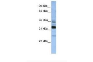 Image no. 1 for anti-Thioredoxin-Related Transmembrane Protein 4 (TMX4) (C-Term) antibody (ABIN6738588) (TMX4 antibody  (C-Term))