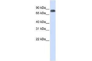 MST1 antibody used at 1 ug/ml to detect target protein. (MST1 antibody)