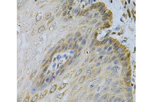 Immunohistochemistry of paraffin-embedded Human esophagus using PGK1 Polyclonal Antibody at dilution of 1:100 (40x lens). (PGK1 antibody)