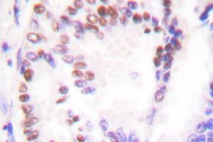 Image no. 1 for anti-Histone Deacetylase 9 (HDAC9) antibody (ABIN265461) (HDAC9 antibody)