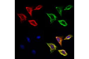 ABIN6260581 and ABIN6277918 staining Hela cells by IF/ICC.