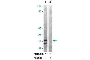 Western blot analysis of extracts from 293 cells treated with Forskolin (40 nM, 30 min) using YWHAZ polyclonal antibody . (14-3-3 zeta antibody)