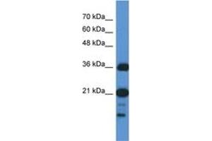 Image no. 1 for anti-Chromosome 1 Open Reading Frame 144 (C1orf144) (N-Term) antibody (ABIN6745087) (C1orf144 antibody  (N-Term))