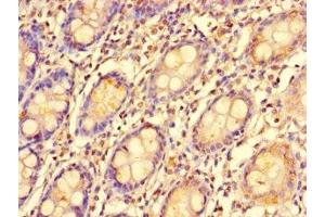 Immunohistochemistry of paraffin-embedded human colon tissue using ABIN7151974 at dilution of 1:100 (EDEM2 antibody  (AA 22-300))