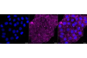 Immunocytochemical staining of HT- cells with G protein subunit beta 2 antibody (ABIN7798822), 1:1,000).