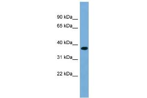 WB Suggested Anti-RPRD1B Antibody Titration: 0. (RPRD1B antibody  (Middle Region))