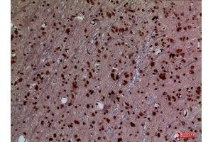 Immunohistochemistry (IHC) analysis of paraffin-embedded Rat Brain, antibody was diluted at 1:100. (HOXD3 antibody  (Internal Region))