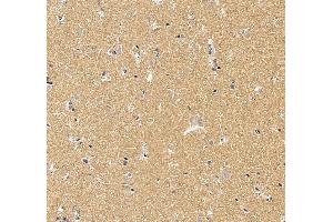 anti-Wolfram Syndrome 1 (WFS1) (AA 61-313) antibody