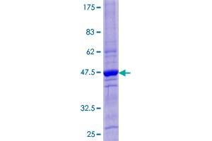 CST4 Protein (AA 1-141) (GST tag)
