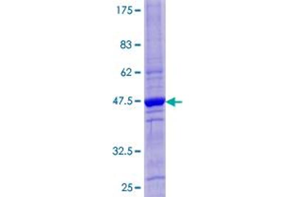 CST4 Protein (AA 1-141) (GST tag)