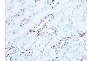 Immunohistochemistry of paraffin-embedded rat kidney using IR Rabbit mAb (ABIN7268009) at dilution of 1:100 (40x lens). (IRAK2 antibody)