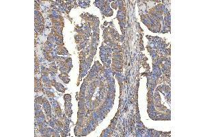 IHC analysis of TXNDC5 using anti-TXNDC5 antibody (ABIN7599699). (TXNDC5 antibody  (AA 109-403))