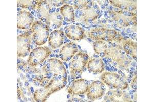 Immunohistochemistry of paraffin-embedded Rat kidney using ST3GAL4 Polyclonal Antibody at dilution of 1:200 (40x lens).